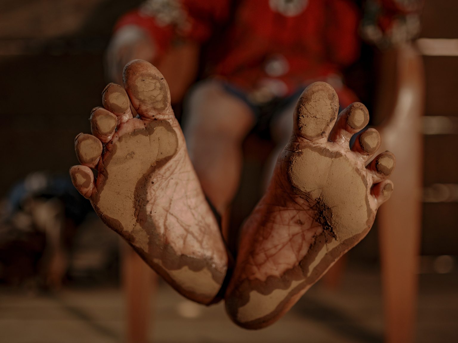 Ambo Enre shows a thick layer of dust coating his feet. Each day, dust from two nickel smelter facilities drifts into his home, settling on the floor and in every corner. He must wash his feet repeatedly, but when he’s too exhausted, he sometimes goes to bed with them still dust-covered.