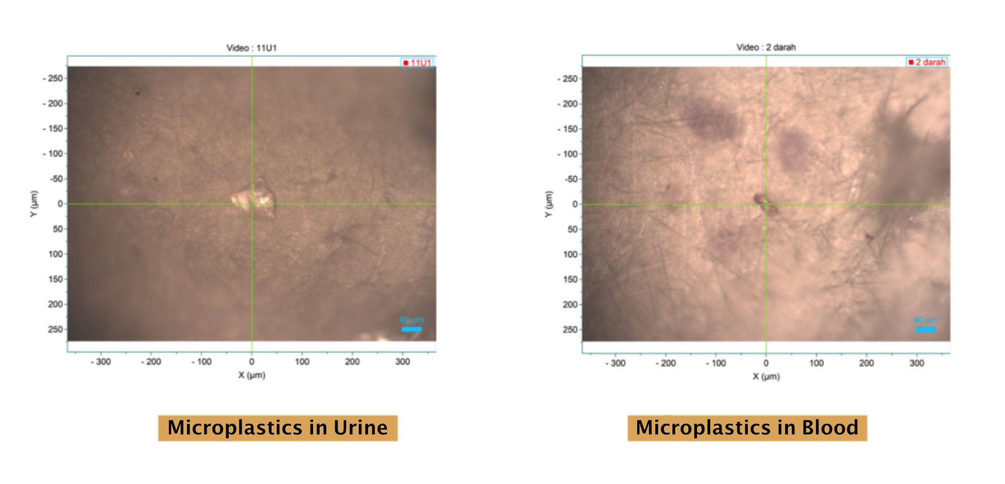 Microplastics detected in respondents’ urine and blood samples from a University of Indonesia-Greenpeace Indonesia study published in February 2025.